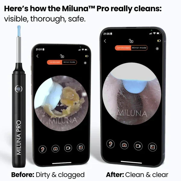 Ear Wax Removal Kit