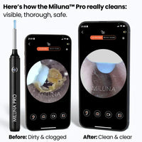 Ear Wax Removal Kit